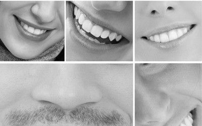 Which patients have the healthiest mouths?